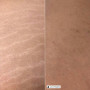 Крем‑флюид для шеи и декольте Formative Neck & Décolleté Fluid, 50 мл Дерма СР (Derma SR) - Швейцария фото 2